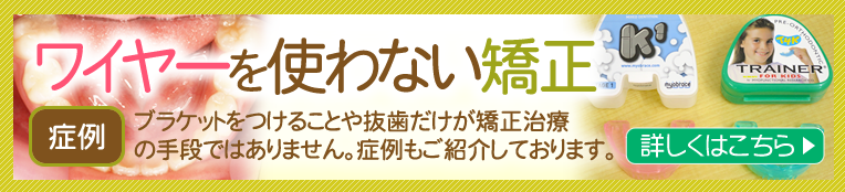 ワイヤーを使わない矯正　当院の症例を掲載しております。